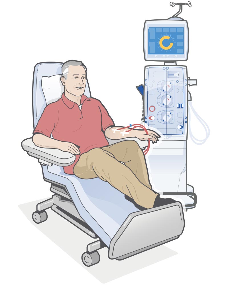 Paciente recibiendo tratamiento de hemodiálisis